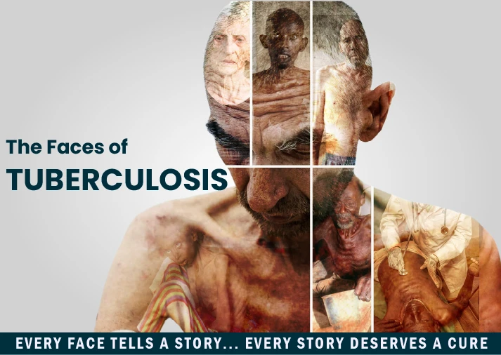 The Faces of Tuberculosis